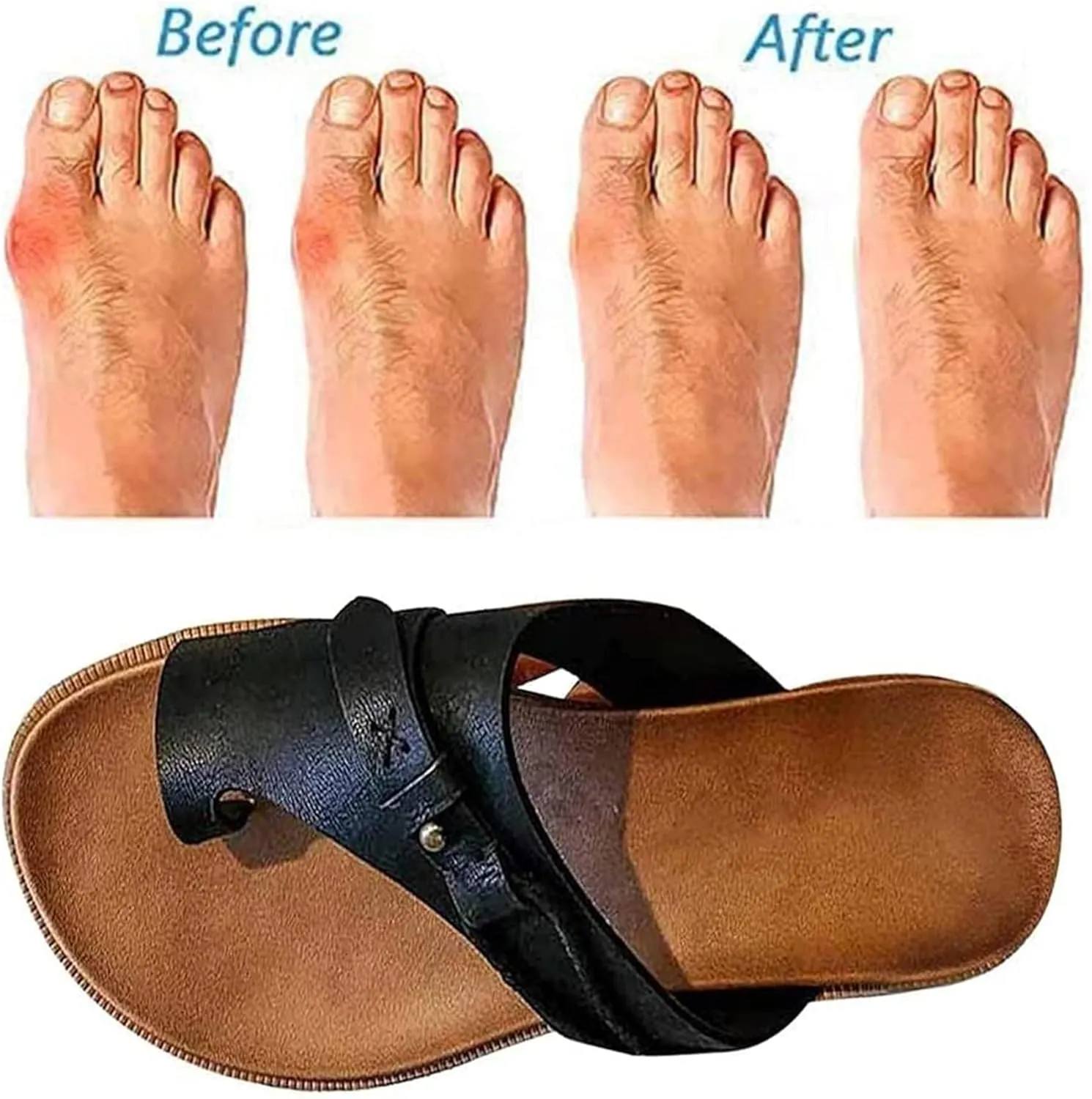 Women Comfy Sandal Big Toe Correction Sandal Orthopedic Bunion Corrector Summer Sandals PU Leather Platform Flat Sole Beach Shoes,Black,EU40/US8